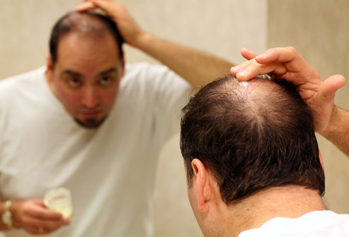 Hair receding - Informed about hair loss